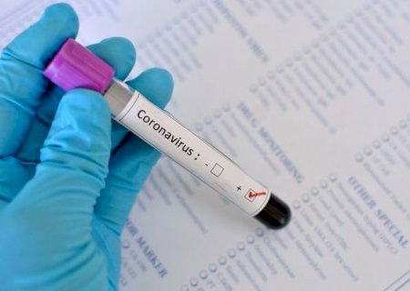 DEODÁPOLIS: Município tem o primeiro caso confirmado de Coronavírus
