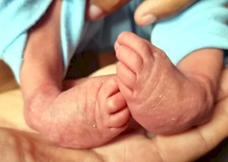 Casal  de Fátima do Sul precisa de ajuda para tratamento e cirurgia de bebê com pé congênito>