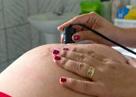 Justiça autoriza mulher interromper gravidez por má formação do feto em Mato Grosso do Sul
