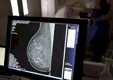 Justi&ccedil;a autoriza que detenta que está em Jateí deixe pres&iacute;dio para investigar c&acirc;ncer de mama