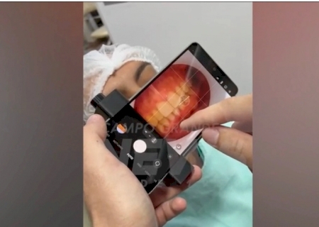 MS integra pesquisa que usa IA para detectar cárie e priorizar demandas no SUS