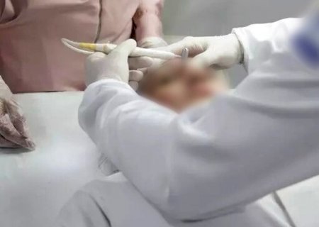 Conselho de Medicina libera uso de fenol mesmo após proibição sanitária