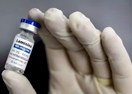 Em meio a alerta sobre polilaminina, pacientes de MS relatam evolução